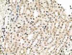 VPS72 Antibody in Immunohistochemistry (Paraffin) (IHC (P))