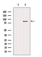 ZNF225 Polyclonal Antibody