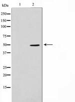 ADPGK Antibody in Western Blot (WB)