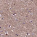 ACTG2 Polyclonal Antibody