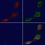 DCP1A Polyclonal Antibody