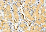 DCP1A Antibody in Immunohistochemistry (Paraffin) (IHC (P))