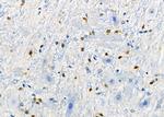 DCP1A Antibody in Immunohistochemistry (Paraffin) (IHC (P))