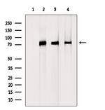 DCP1A Antibody in Western Blot (WB)