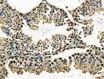 IRX2 Antibody in Immunohistochemistry (Paraffin) (IHC (P))