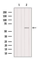 ZNF682 Antibody in Western Blot (WB)