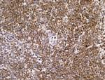 PIAS1 Antibody in Immunohistochemistry (Paraffin) (IHC (P))