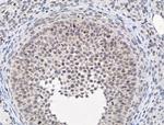 PIAS1 Antibody in Immunohistochemistry (Paraffin) (IHC (P))