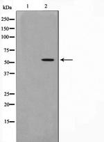 PKNOX2 Antibody in Western Blot (WB)