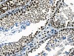 TRIP13 Polyclonal Antibody