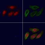 LYK5 Polyclonal Antibody