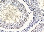 LYK5 Antibody in Immunohistochemistry (Paraffin) (IHC (P))