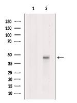 LYK5 Antibody in Western Blot (WB)