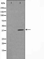 TUSC3 Polyclonal Antibody
