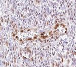 Gastrin Polyclonal Antibody
