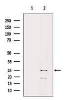NRIP2 Antibody in Western Blot (WB)
