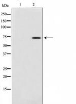 COL13A1 Polyclonal Antibody