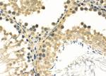 FOXJ3 Antibody in Immunohistochemistry (Paraffin) (IHC (P))