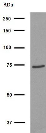 FOXJ3 Antibody in Western Blot (WB)