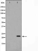 AKAP14 Antibody in Western Blot (WB)