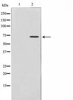 DYRK1B Polyclonal Antibody
