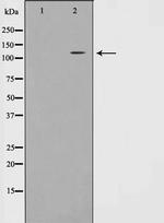 EphA7 Antibody in Western Blot (WB)