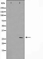 HOXD12 Polyclonal Antibody