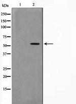 ZNF187 Polyclonal Antibody