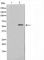 TBX22 Polyclonal Antibody