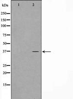 CARP Polyclonal Antibody