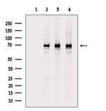 Epsin 2 Antibody in Western Blot (WB)