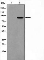 AAK1 Polyclonal Antibody
