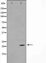 TPD52L2 Polyclonal Antibody