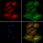 TTC23 Polyclonal Antibody