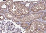 CYP2J2 Polyclonal Antibody