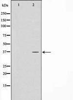 CTU1 Polyclonal Antibody