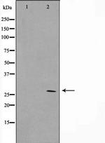 SIX6 Antibody in Western Blot (WB)