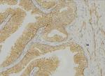 Cytokeratin 14/16 Polyclonal Antibody