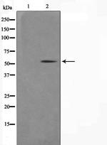 Cytokeratin 14/16 Antibody in Western Blot (WB)