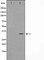 FOXE1 Polyclonal Antibody