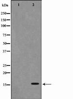 PFDN1 Polyclonal Antibody