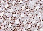 ZNF148 Antibody in Immunohistochemistry (Paraffin) (IHC (P))