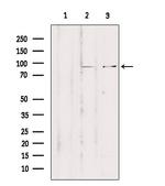 ZNF148 Antibody in Western Blot (WB)