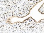 Phospho-NBS1 (Ser278) Polyclonal Antibody