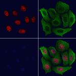 H3K23ac Polyclonal Antibody