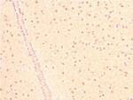 Acetyl-p53 (Lys319) Antibody in Immunohistochemistry (Paraffin) (IHC (P))