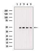 Phospho-HDAC3 (Ser424) Antibody in Western Blot (WB)