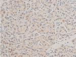 Phospho-TAK1 (Thr187) Polyclonal Antibody