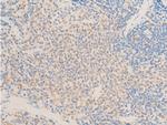 Phospho-TAK1 (Thr187) Antibody in Immunohistochemistry (Paraffin) (IHC (P))