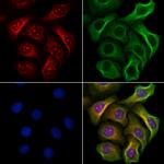 Phospho-JAK2 (Tyr1007) Polyclonal Antibody